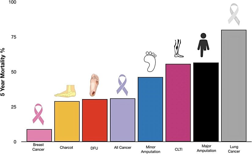 Görselde diyabetik ayak komplikasyonları ve kanserde beş yıllık mortalitenin karşılaştırılıyor. DFU, diyabetik ayak ülserlerini ifade ediyor. Majör amputasyon ise ayak seviyesinin üzerine çıkan amputasyonu ifade ediyor.