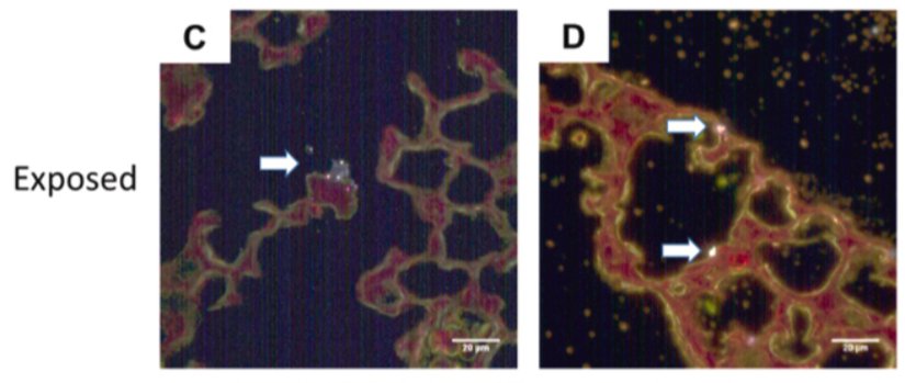 2 haftalık erkek (C) ve dişi (D) fare yavrularının akciğerlerinde tespit edilen mikro nanoplastikler