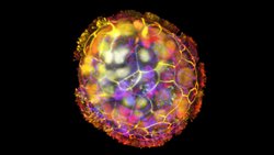 İnsan Hücrelerinden Yapılmış Küçük Robotlar Hasarlı Dokuları İyileştirebiliyor!