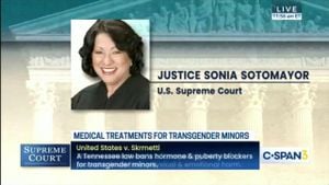 Supreme Court Justice Sotomayor Compares Risks Of Transgender Treatments To Aspirin