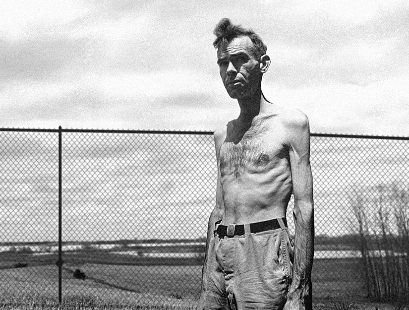 Gönüllülerin kemikleri belirginleşiyordu