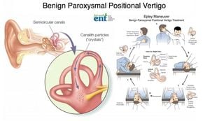 Blood Pressure Responses Linked To BPPV Recurrence Risk