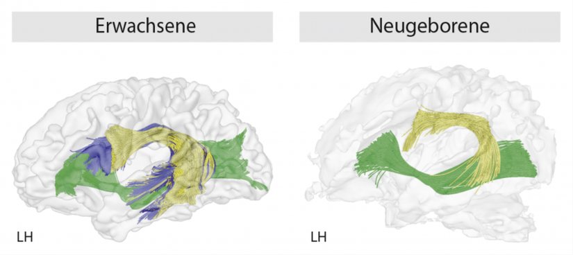 Dil, bebeklikten (Neugeborene) yetişkinliğe (Erwachsene) kadar farklı bir hızla olgunlaşır. Fasciculus arcuatus olarak bilinen akson demeti, yetişkinliğe ulaşana kadar tam olarak gelişmez ve gelişme tamamlandığında kısa yapısı (sarı bölüm), uzun bir yapı (mavi bölüm) ile kaplanır. Ancak o zaman bu sinir demeti Broca bölgesinden Wernicke bölgesine bilgi gönderebilir ve böylece karmaşık cümleleri işleyebiliriz. LH = beynin sol tarafı.