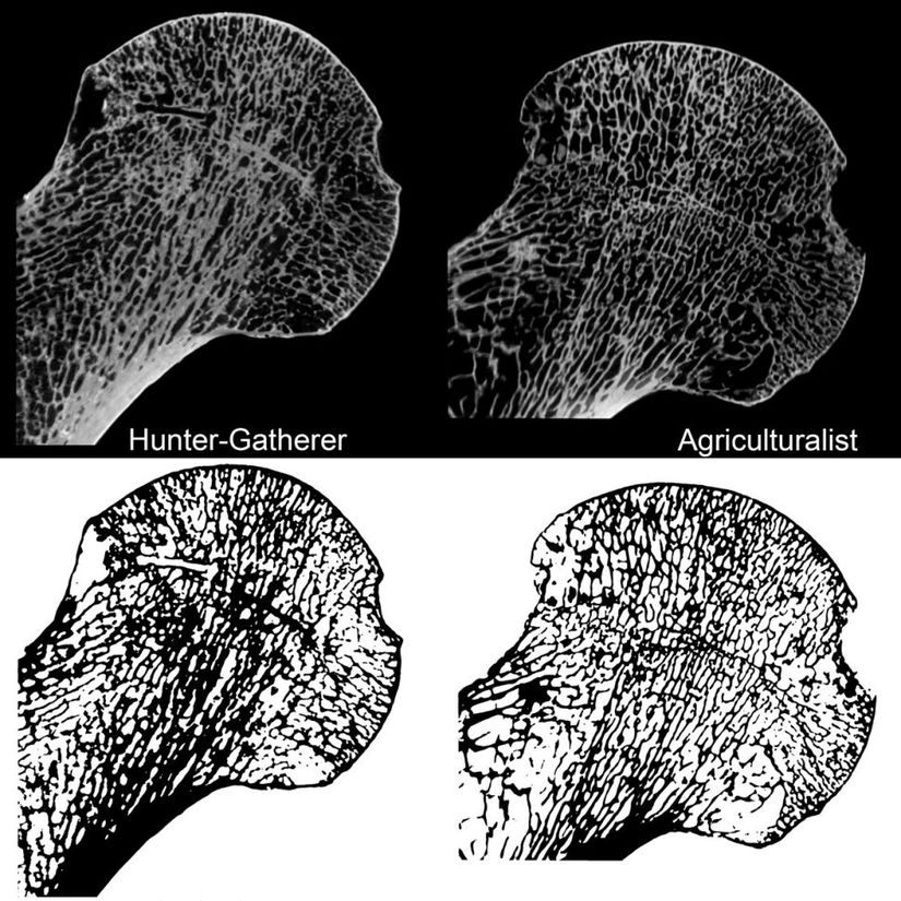 Göreceli olarak daha az hareket eden insan tarımcıları (sağda), daha hareketli olan avcılara kıyasla (solda) daha zayıf iskeletlere sahiptir. Görselde, femur başına yönelik 2 boyutlu mikro CT görüntüleri görülmektedir.