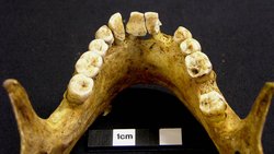 Dental Calculus Sheds Light on Our Evolutionary History