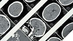 Davranışsal Özelliklerin Nöroanatomik İncelenmesi