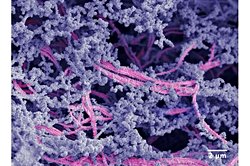 Yeni Biyomateryal Diz Kıkırdağını Yenileyerek Protez Ameliyatlarını Önleyebilir.