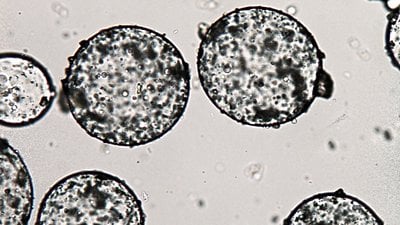 Koaservat Nedir? İlkin Koaservat Yapıları Nasıl Oluşmuştur?