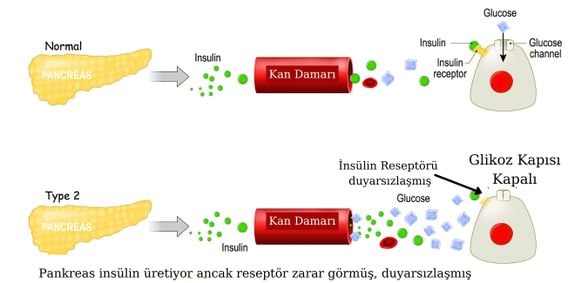 Tip 2 diyabet