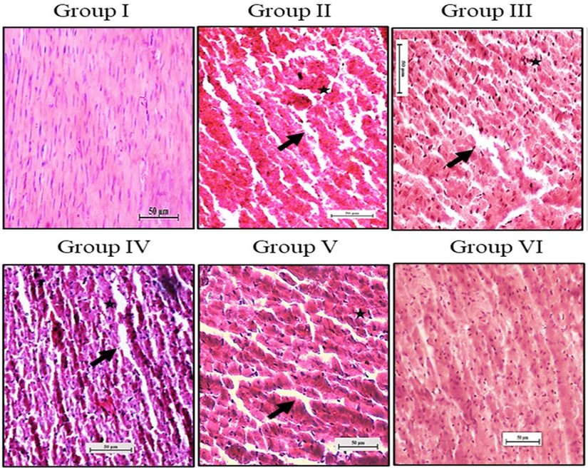 Kardiyak fibrozis  Histoloji Mikroskop Görüntüsü