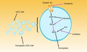 FZD7 Identified As Key Diagnostic Gene Linked To Ferroptosis Resistance