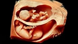 Bir Bebeğin 3 Boyutlu ve 4 Boyutlu Ultrason Görüntülerini Almak Mümkün ve Bu, Sigaranın Bebekler Üzerindeki Zararlarını Gösteriyor!