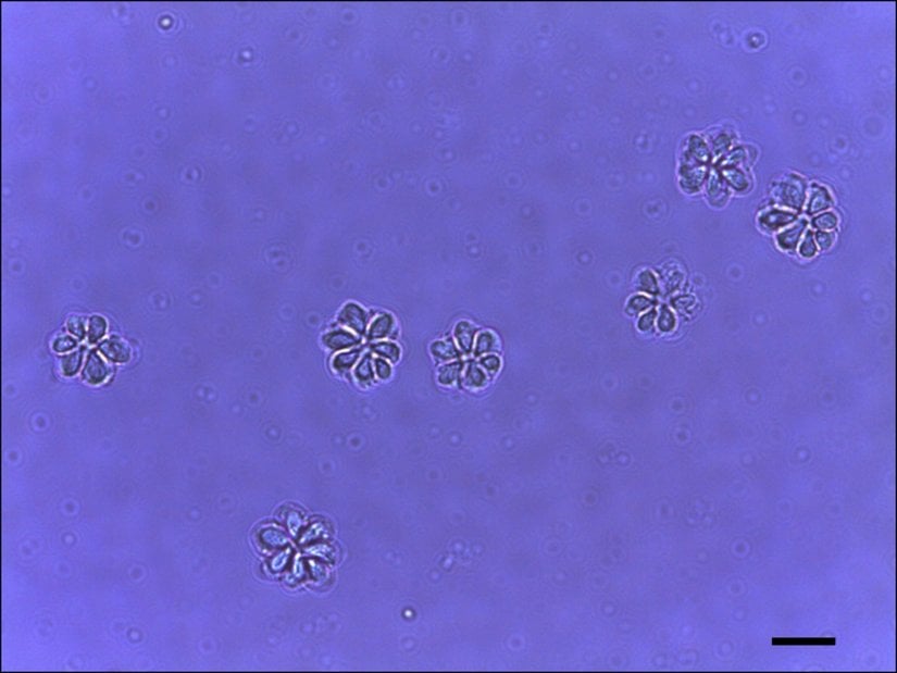 Myxosporea üyelerinden biri olan Kudoa septempunctata türünün sporları.