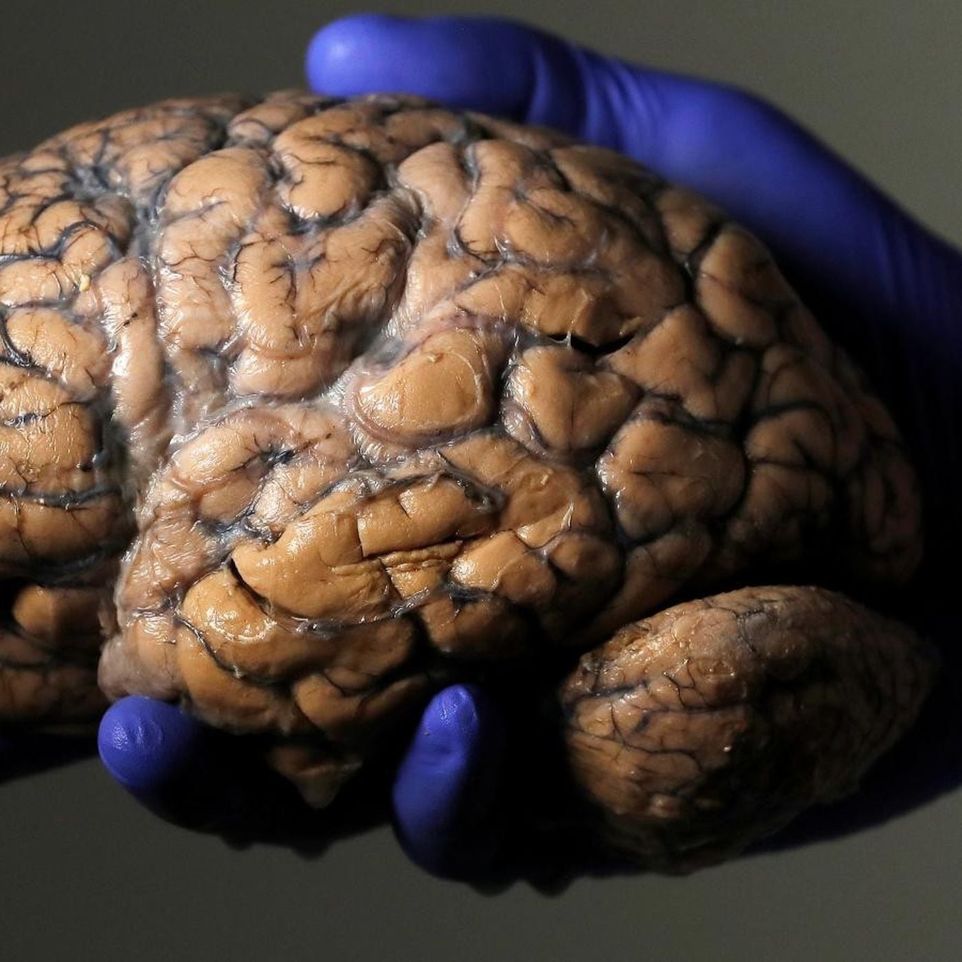 Beyinle İlgili 10 Yanlış Bilgi ve Bunların Gerçekleri