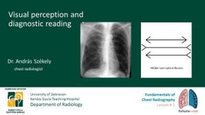 Medical Imaging Experts Show Reduced Susceptibility To Visual Illusions