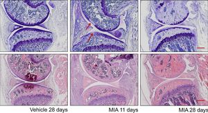 Zebrafish Model Offers New Insights Into Osteoarthritis Research