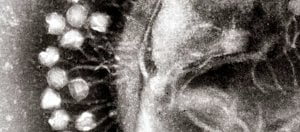 Kanseri Mutant Virüslerle Yenmek...