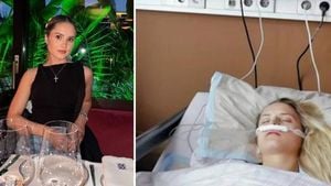 Davina Geiss Undergoes First Nose Surgery At 21