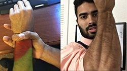 Neden bazı insanların ince bileği varken bazı insanların kalın bileği var?