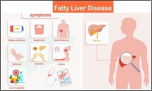 New Study Links Chronic Pain To Increased Liver Fat Accumulation