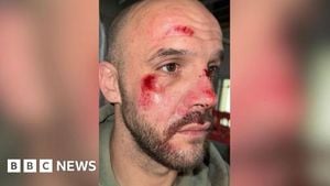 Hit And Run Tragedies In Queensland And Pennsylvania Spark Outcry