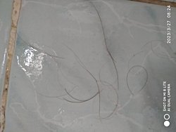 Saç dökülmesi ve saç kırılması arasındaki fark nedir?