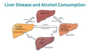 Alcohol Consumption Leads To Serious Liver Damage Risks