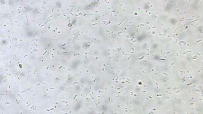 Bakteriler (Bacteria)