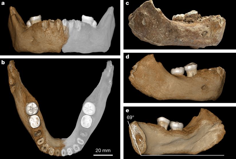 Bulunan Denisovan çene kemiğinin orijinalinin (c) ve rekonstrüksyonunun (a,b,c,d) farklı açılardan görüntüsü