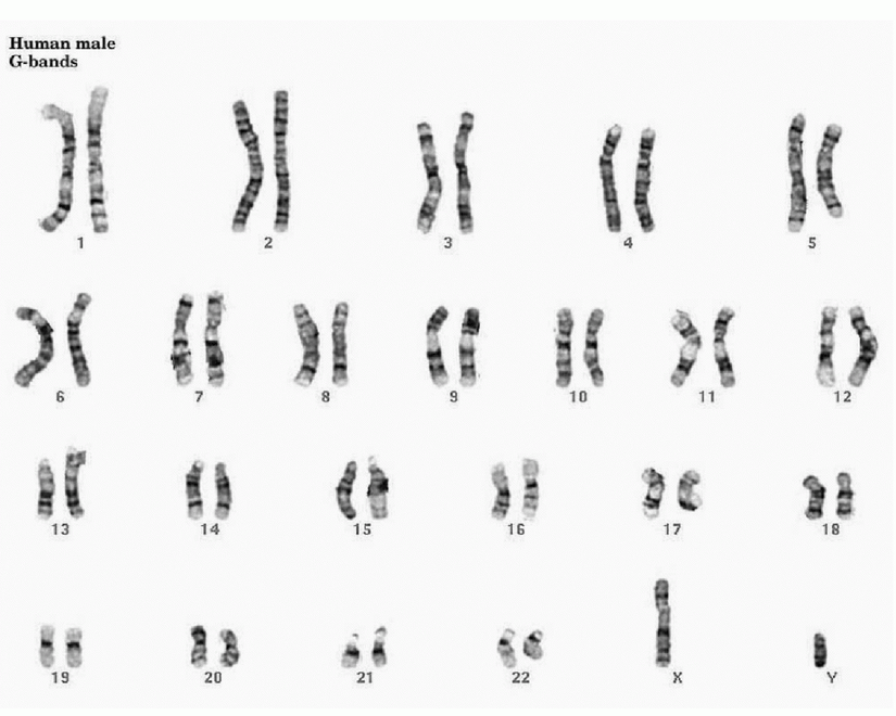 İnsan erkeğinin kromozom haritası...