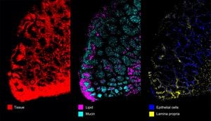 Raman Spectroscopy Imaging Boosts Glioblastoma Surgery Accuracy