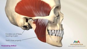 New Combined Treatments Show Promise For TMJ Disorders