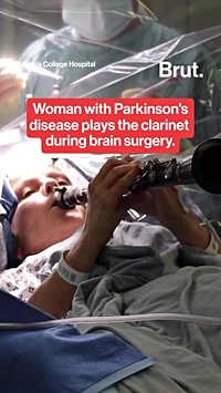 Parkinson's patient plays the clarinet during brain surgery