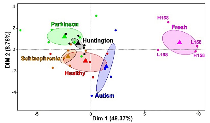 Fig.2 - Epileptik aktiviteden bağımsız olarak ölüm sonrası örnekler arasında en çok anlatımda azalma gösteren genler. Her nokta verilen örnekle örtüşüyor, kütle merkezleri üçgenlerle gösteriliyor ve kütle merkezlerinin %80’ni pozisyonlarını koruyor. İki ayrı hastadan (EP158 ve EP168) alınan 4 örneğin analizi görünüyor. Burada “L” (low) düşük aktiviteli beyin bölgelerini gösterirken, “H” (high) yüksek aktiviteli beyin bölgelerini belirtir.