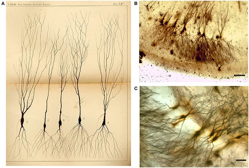 Şekil 2: Çizim (A) ve tavşanın Camillo Golgi emdirilmiş Ammon boynuzundan görüntüler (B,C). (A) Çizim Camillo Golgi'nin (1885) XIII numaralı tabağıdır. &quot;Sinir sürecinin&quot; ilk kısmı (akson) kırmızı ile çizilmiş ve Camillo Golgi açıklama kısmında &quot;bu kısmın bolca dallanan çok sayıda ikincil fibrillere dallanmasının genel bir kural olarak kabul edilmesi gerektiğini&quot; belirtmiştir.