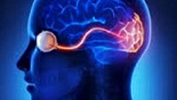 Optik sinir tedavisi