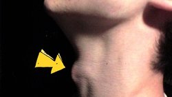Adam's Apple: What Is It and Why Do We Have One?