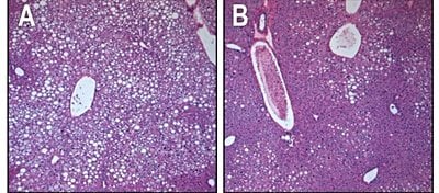 Farelerdeki Tip 2 Diyabet Semptomları Hiçbir Bilindik Yan Etki Olmadan Tersine Çevrildi!