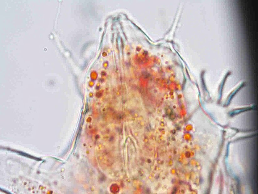 Echiniscus cinsine ait bir bireyin baş bölgesinin etrafında yer alan clava ve sirrus yapılarının gösterimi