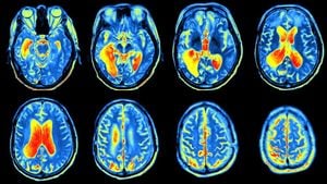 Pozitron Emisyon Tomografisi (PET) Nedir? PET Taraması ile Görüntüleme Nasıl Yapılıyor? Hastalar Nasıl Bir Süreçten Geçiyor?