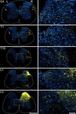 New Research Sheds Light On Spinal Neurons In Pain Perception