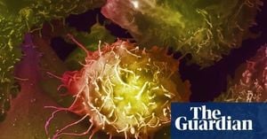 UK Faces Backlash After Prostate Cancer Screening Ruling