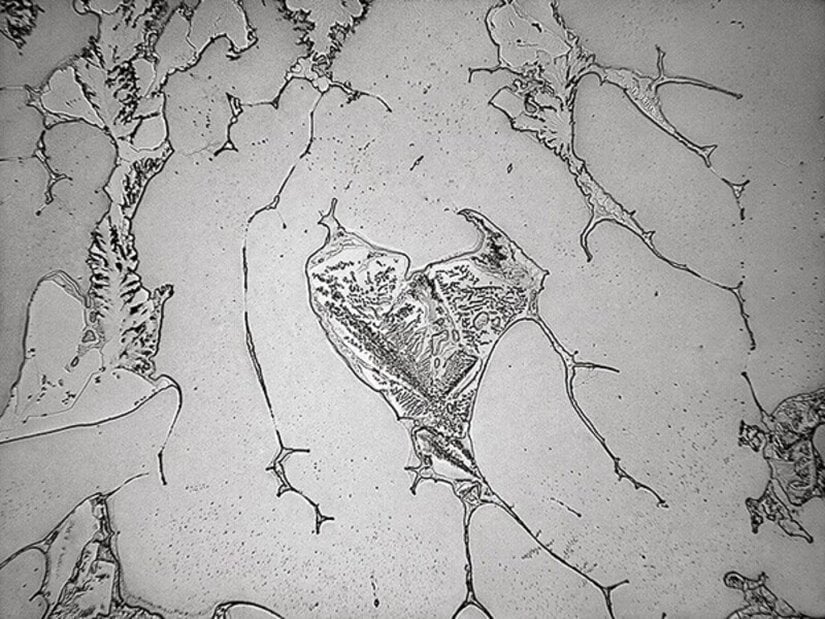 Rose-Lynn Fisher'ın çalışmasında kullandığı ve sonrasında "The Topography of Tears" adlı sergisinde sergilediği mikroskobik gözyaşı fotoğrafları.