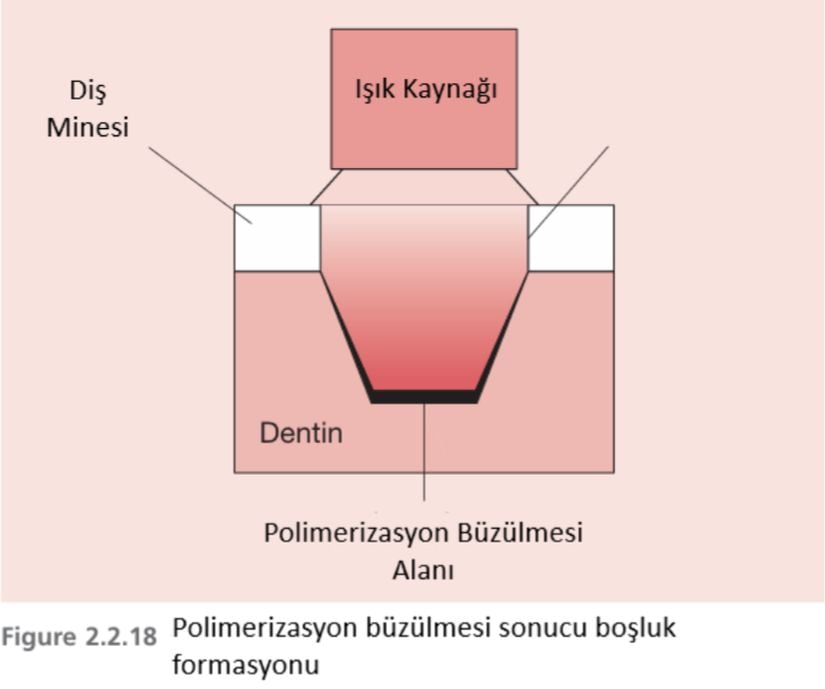 Polimerizasyon büzülmesi,kompozit rezinin yapısında bulunan monomerlerin arasında bulunan zayıf Van der Walls bağlarının daha güçlü olan kovalent bağlara dönüşmesi ile meydana gelen boyutsal kompozit rezindeki boyutsal küçülmedir. Klinik olarak önemi konumuzun kapsamı dışındadır.