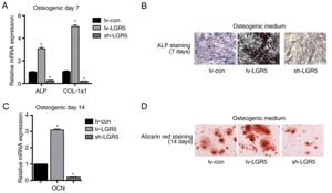 Research Reveals Tipifarnib Rescues Osteoblast Growth Impaired By HRAS Mutations