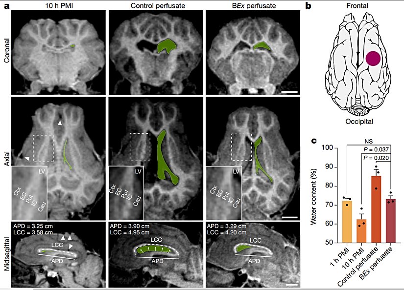 İncelenen beyin bölgeleri