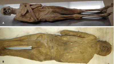 Yüzlerce Yıl Hiç Bozulmadan Kalan Avusturyalı Bir Papazın Mumyası, Yeni Bir Mumyalama Yöntemi Ortaya Çıkardı!