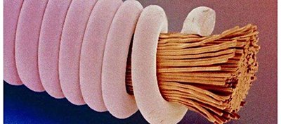 Mikroskop Altında Gitar Teli...