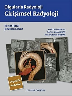 Olgularla Radyoloji Girişimsel Radyoloji