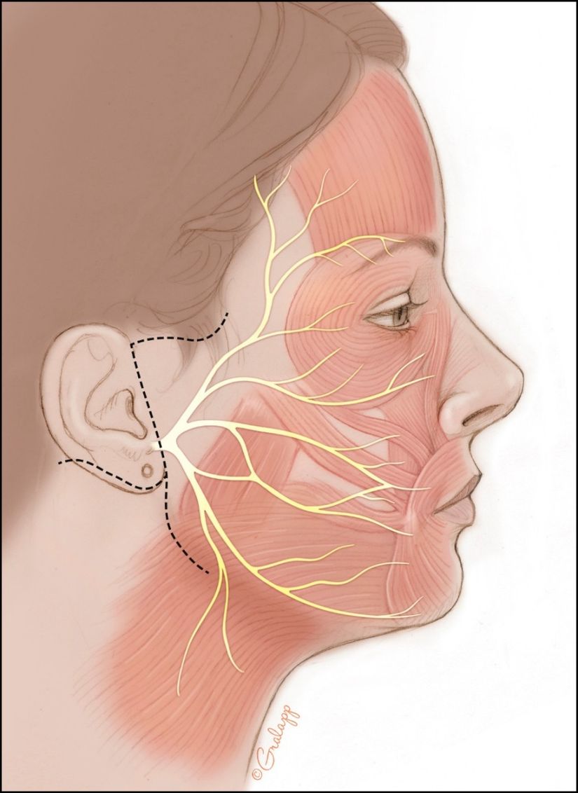 Facial Nerve